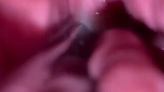 Milf first time speculum, with cum in pussy