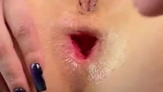 HORNY TEEN NEIGHBOR GIRL MAKES A GAPE, FUCKS HER ASS, AND CUM WITH A SQUIRT. CLOSE UP VIEW. HD VIDEO